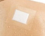 essity Verbandfixierung Fixomull® transparent 15cm