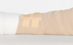 COM-TeX® Derm 2.5cm